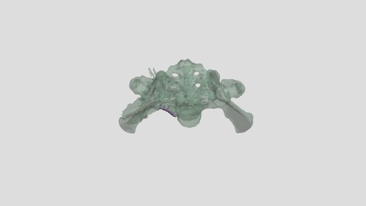Zepeda_Unit 3 Exam Pelvix Segmention 3D Model