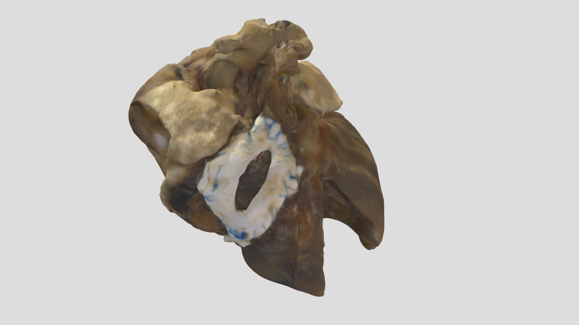 Tricuspid Atresia_A829 - Download Free 3D model by lindseyamilgrom ...