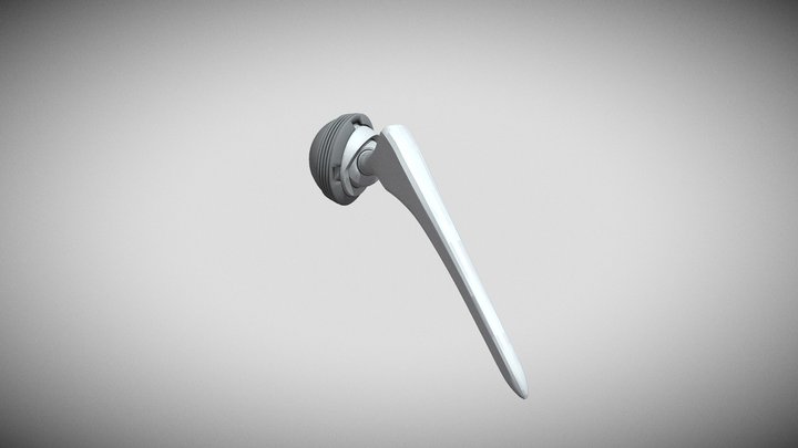 Joint replacement 3D Model