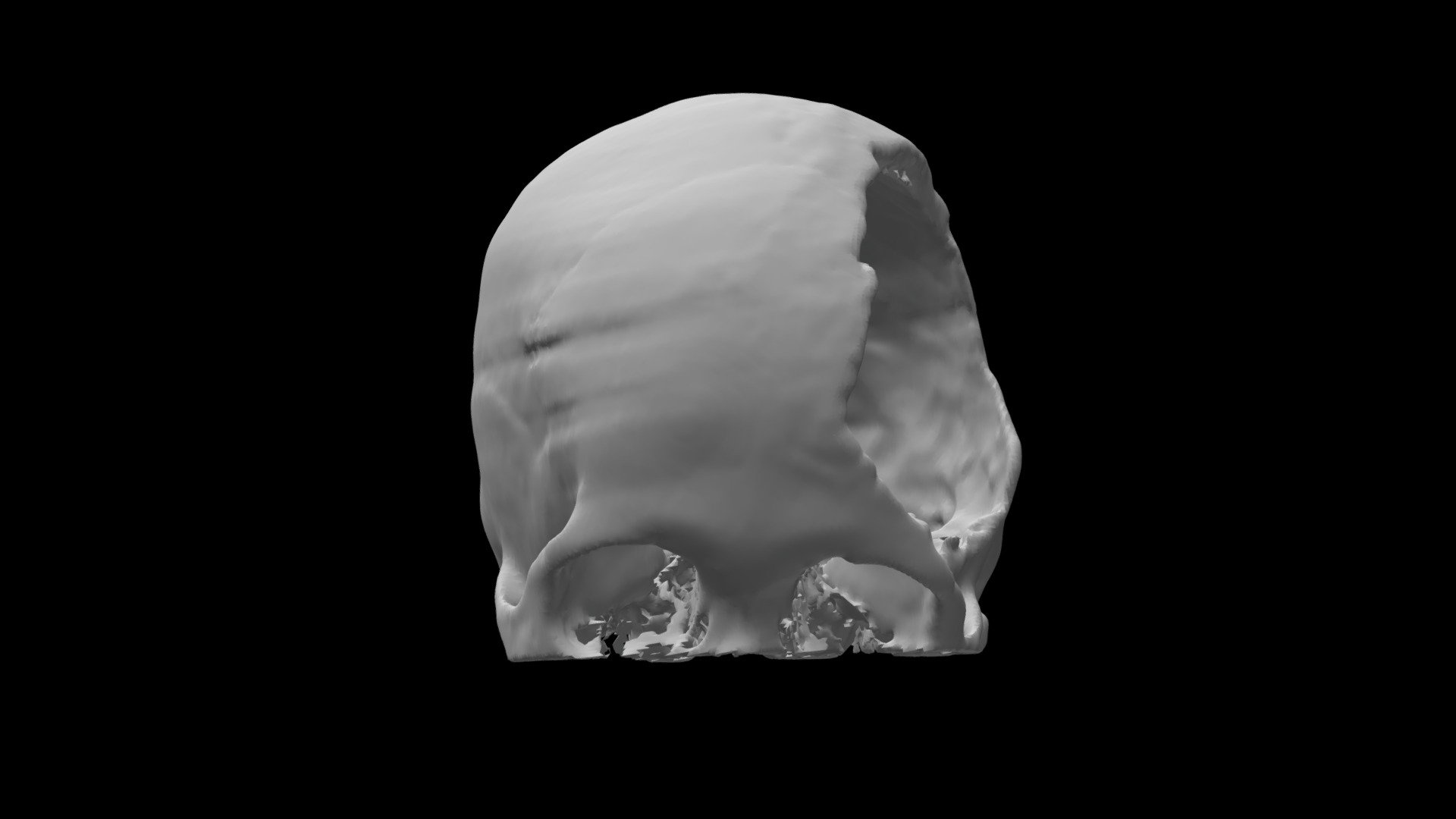 Defect fba50a5e8beb408a9a0ae66b62df8bec - 3D model by healthgate ...