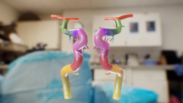 Internal Carotid Artery Segments and Branches – Free 3D Model STL