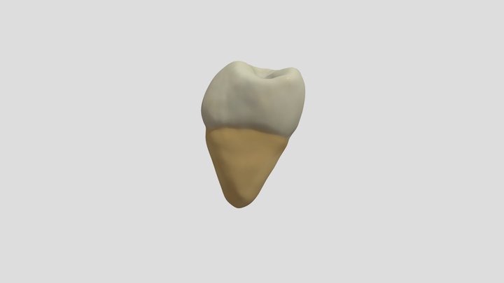 Mandibular Third Molar (Right)