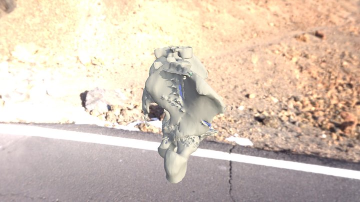 Pelvis Segmentation 3D Model