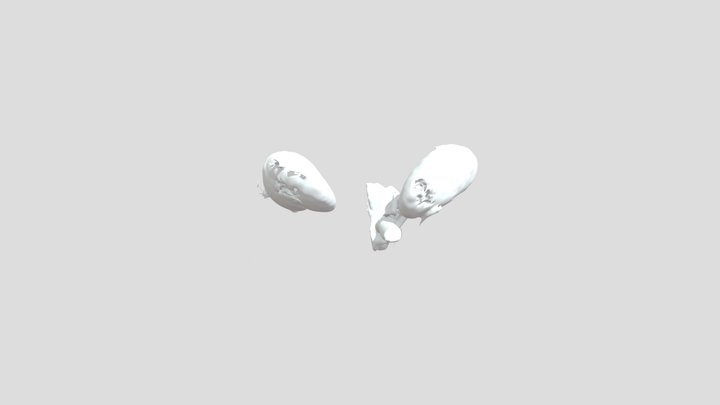 Segmentation of Kidney and Aorta 3D Model
