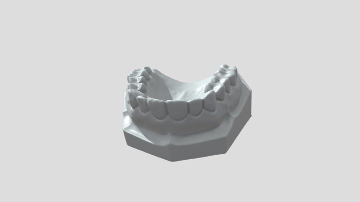 Dentures by Seal Lite