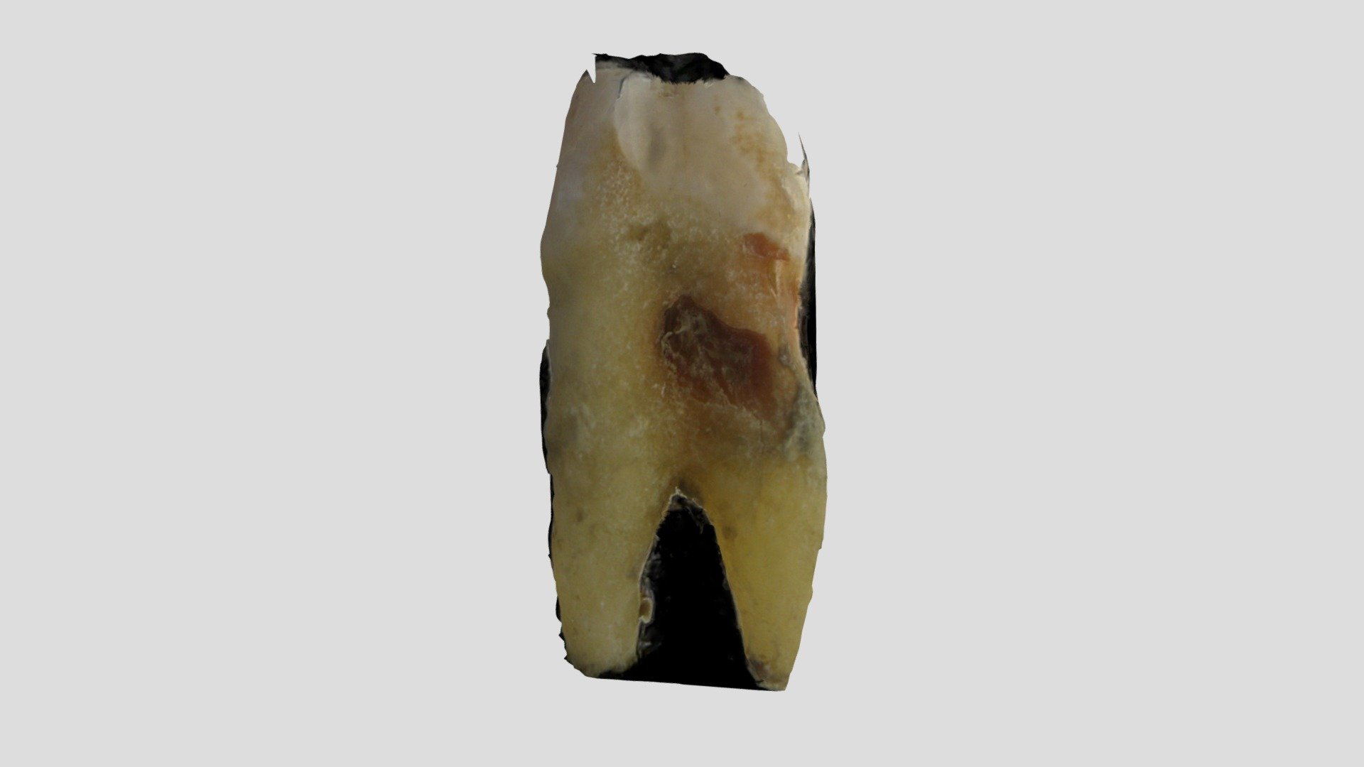 Premolar III
