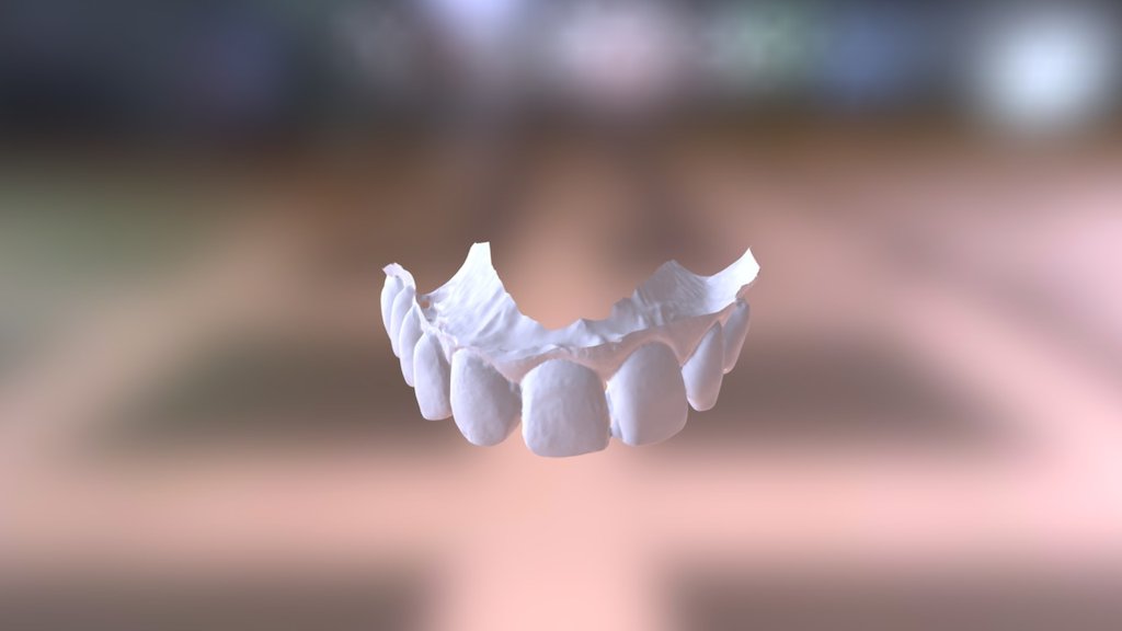Manuela Upper Jaw