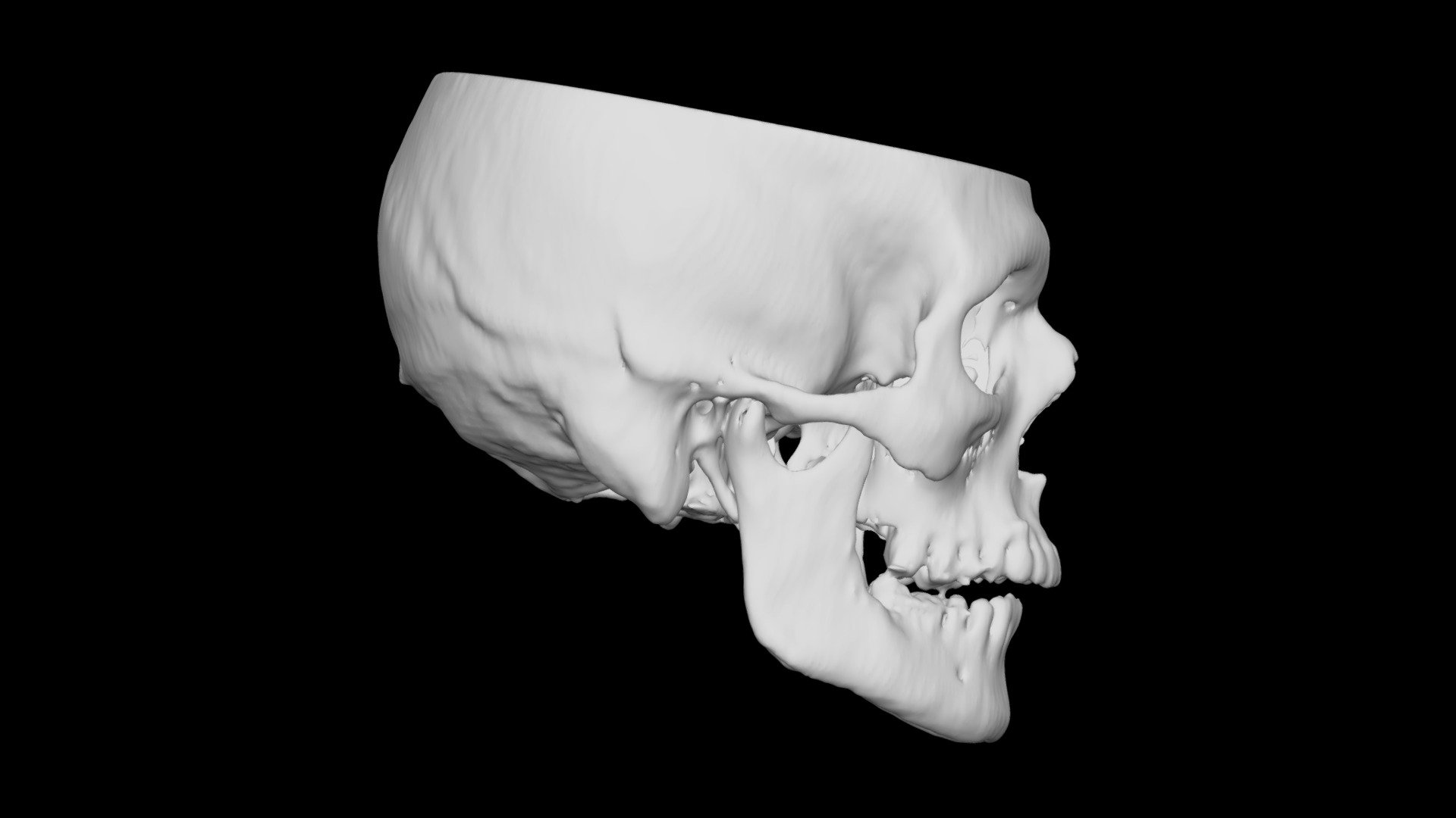 Skull Male 43yo