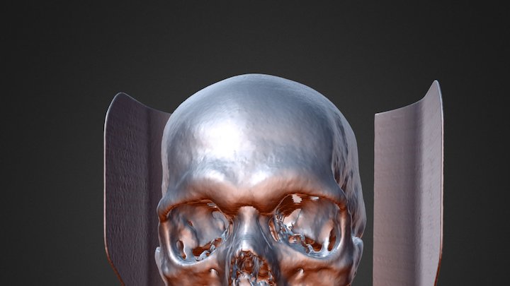 Tom Head CT 3D Model
