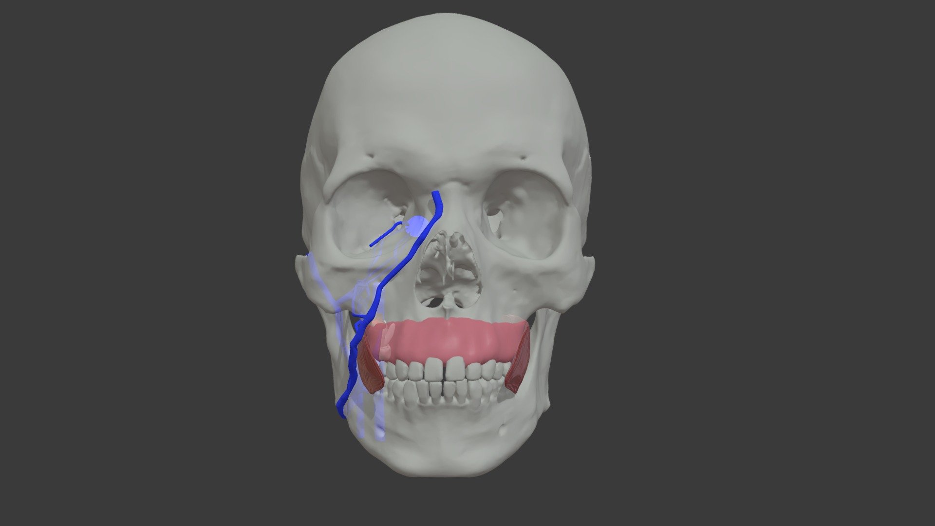 Stage 8 Long Root Maxillary Dental Infection - 3D model by University ...