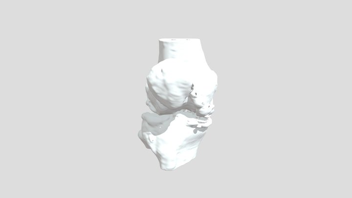 Segmentation_ Na Pa Rt Bone With Osteophy 3D Model