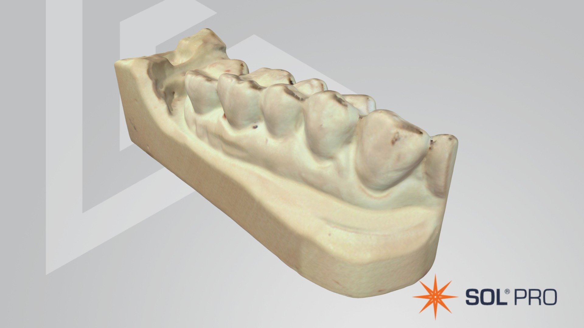Dental cast - SOL PRO — Sketchfab embed 3D viewer