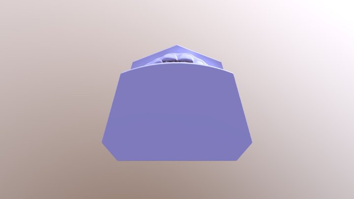简蓝-矫正前-咬合 3D Model
