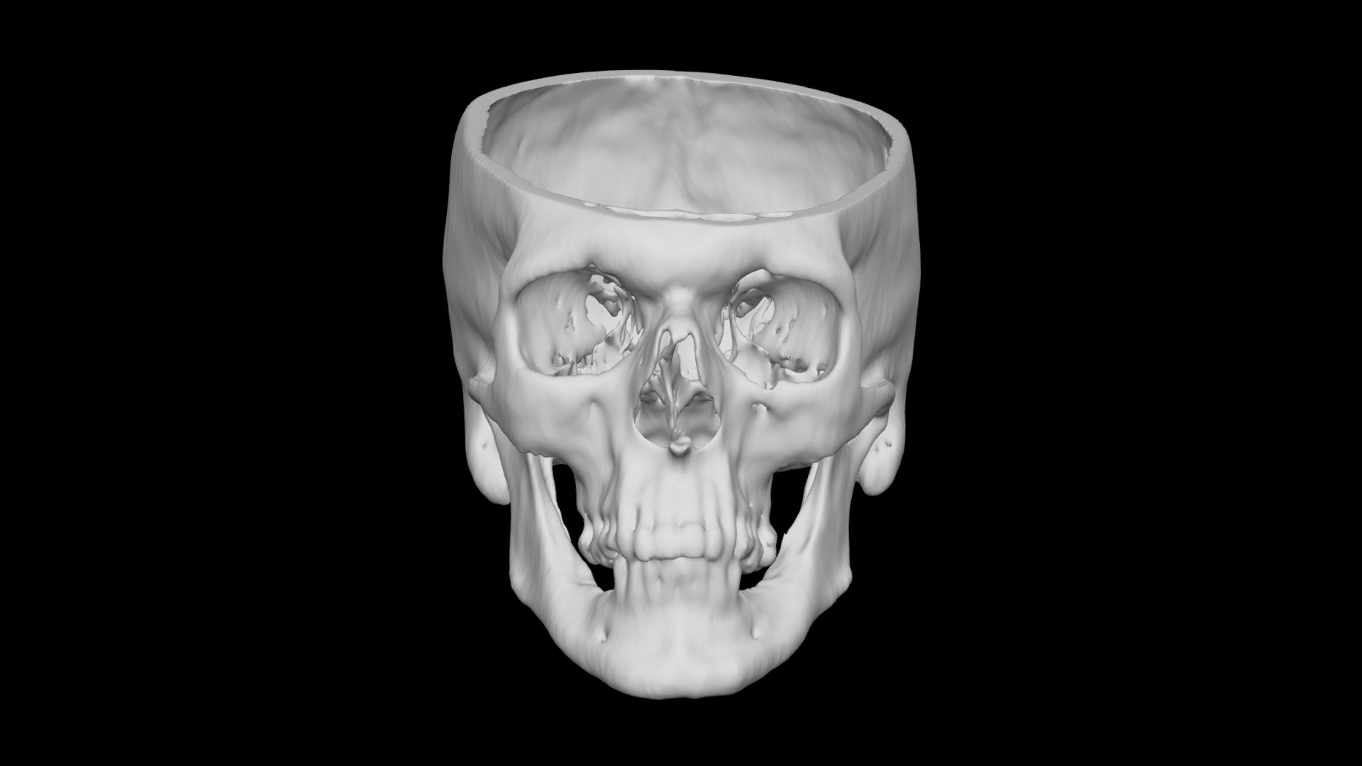 Skull Male 60yo