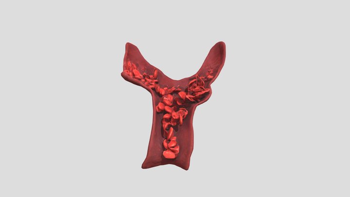 Sickle Cell Blood Flow 3D Model