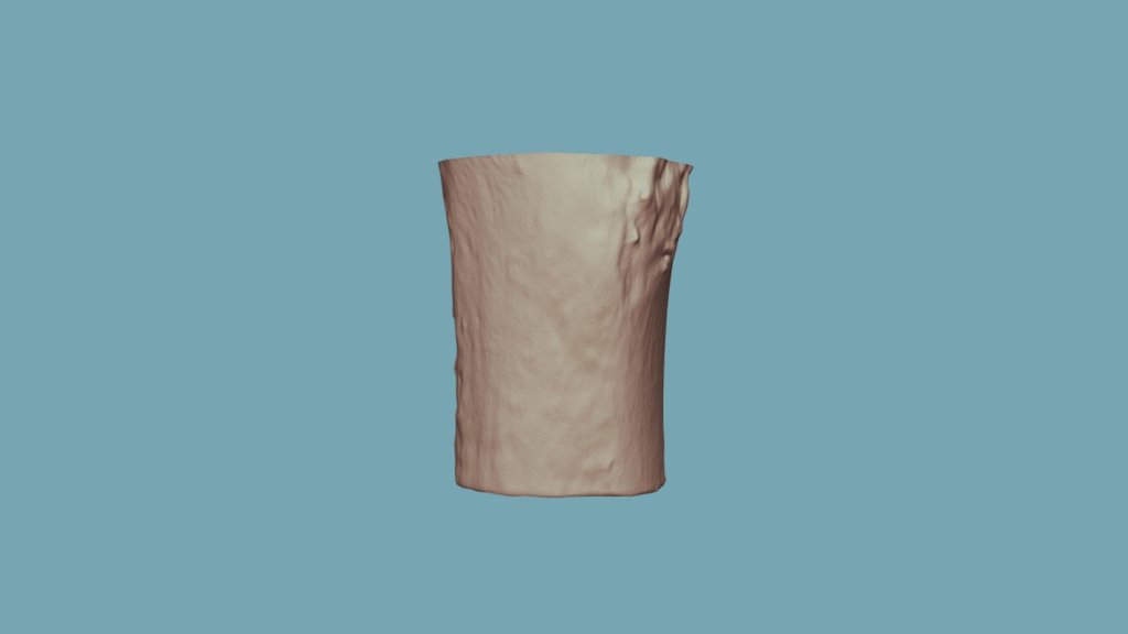 5-3 (Post-burn)