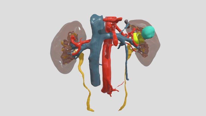 Tumor renal - URO_AAB_230524_1 3D Model