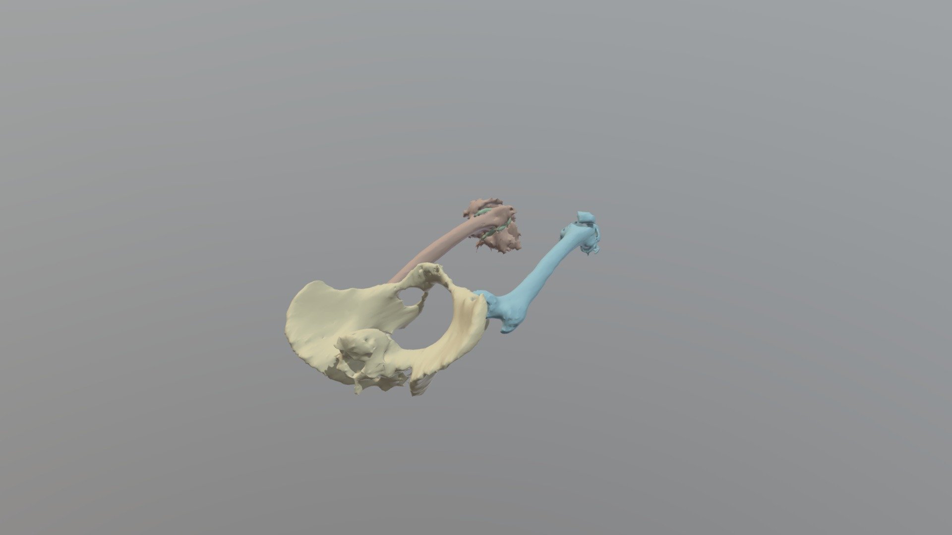 Femurs, Pelvis, and Knee Implant - Download Free 3D model by maxwell ...