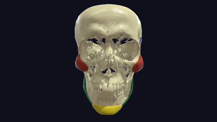 Case ID: 31252613 3D Model