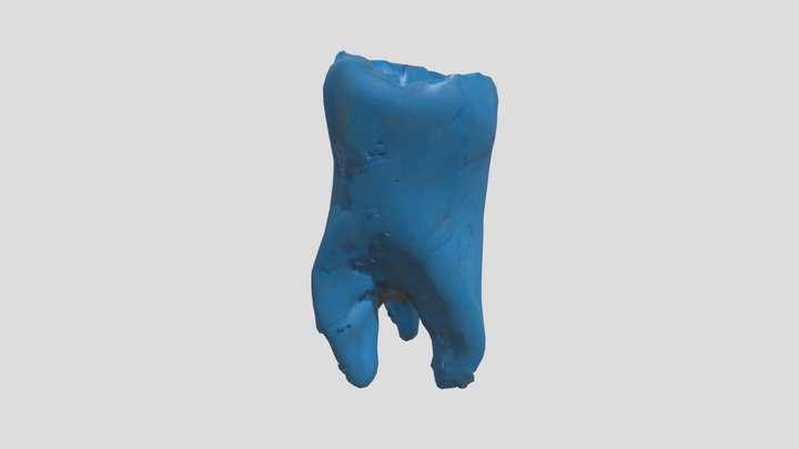 Tooth CCD – Modello 3D gratuito STL