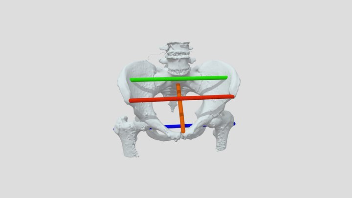 Diametri pelvis 3D Model