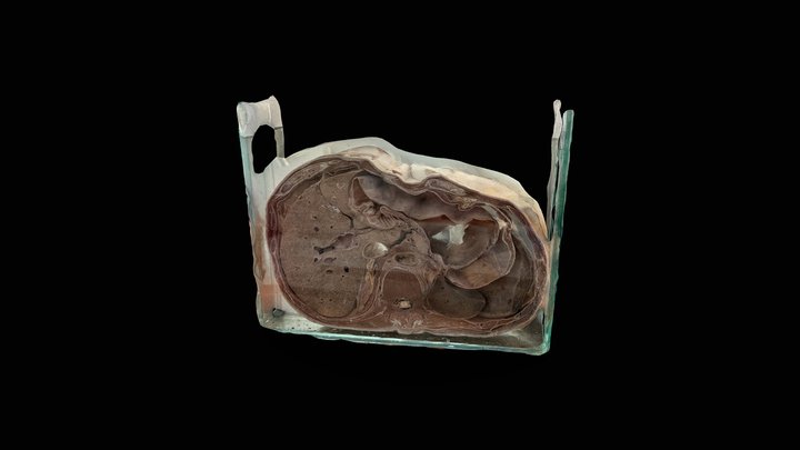 CORTE AXIAL TÓRAX - NIVEL T11-T12 3D Model