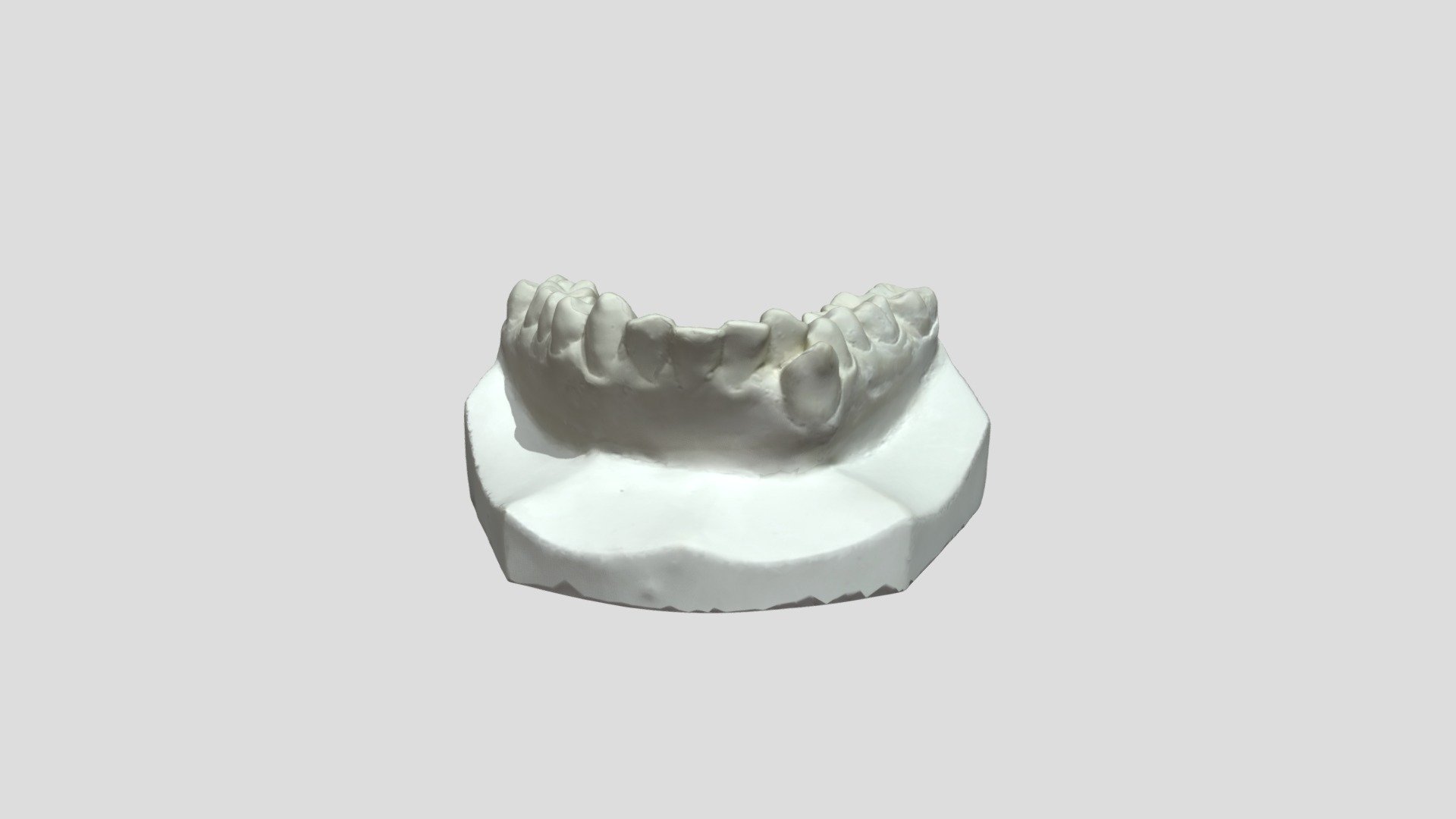 Lower dental model